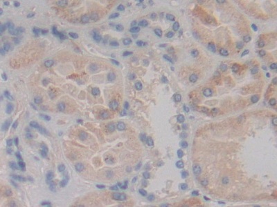 Polyclonal Antibody to Mitogen Activated Protein Kinase Kinase 6 (MAP2K6)