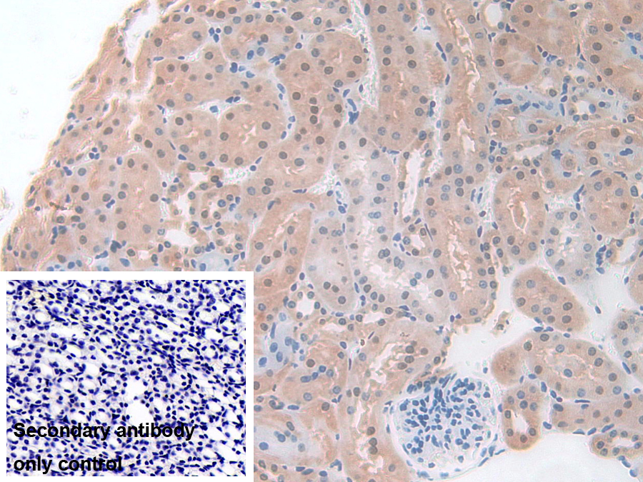 Polyclonal Antibody to Pyridoxal Kinase (PDXK)