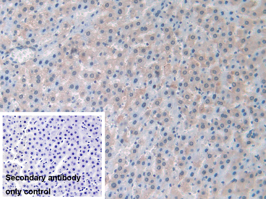 Polyclonal Antibody to Pyridoxal Kinase (PDXK)