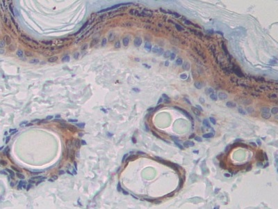 Polyclonal Antibody to Cluster of Differentiation 244 (CD244)