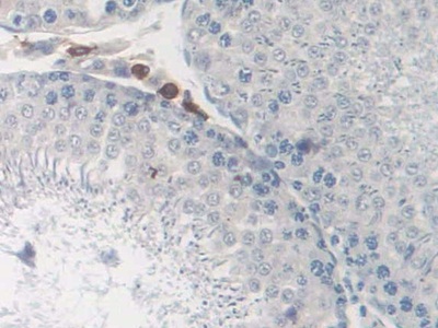 Polyclonal Antibody to Cluster Of Differentiation (CD163)