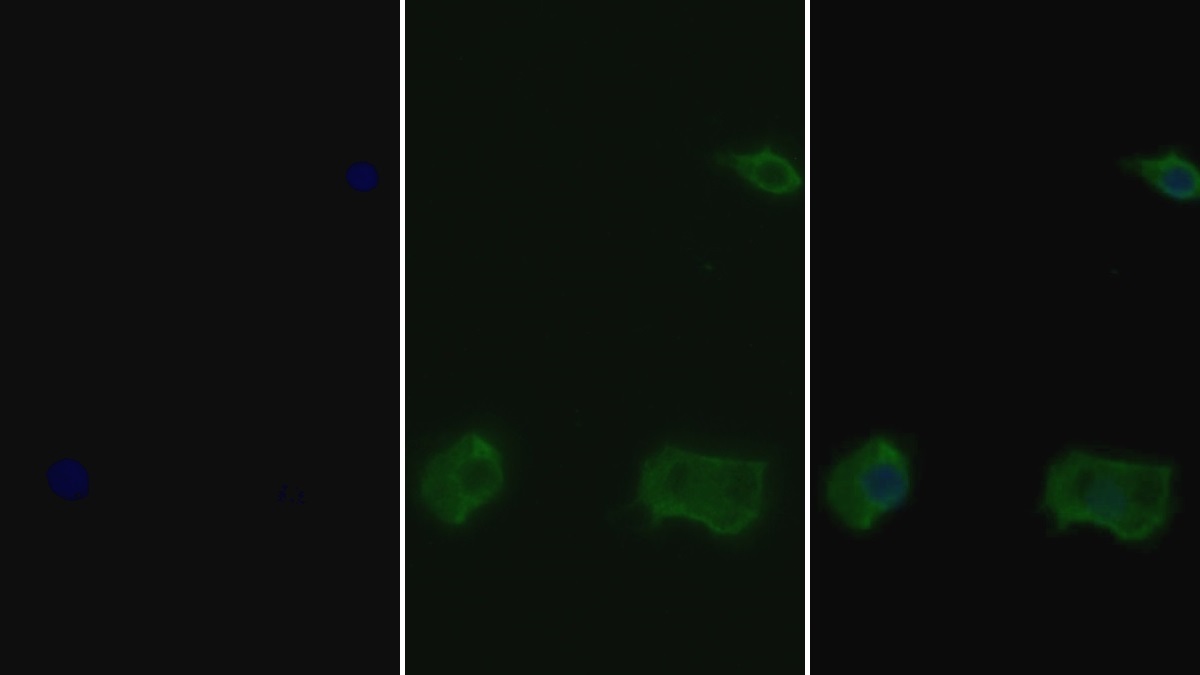 Polyclonal Antibody to Signal Transducer And Activator Of Transcription 5B (STAT5B)