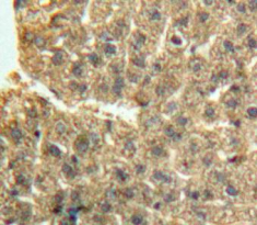 Polyclonal Antibody to Bone Morphogenetic Protein 9 (BMP9)