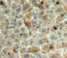 Polyclonal Antibody to Bone Morphogenetic Protein 9 (BMP9)