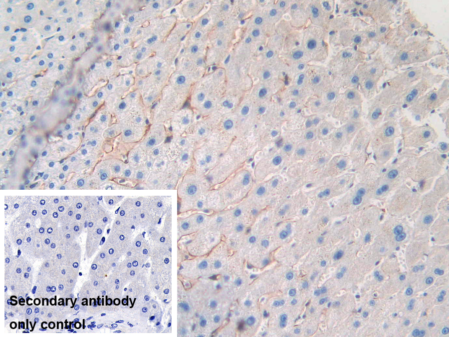 Polyclonal Antibody to Cluster Of differentiation 299 (CD299)