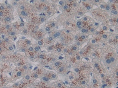 Polyclonal Antibody to Cluster Of differentiation 301 (CD301)