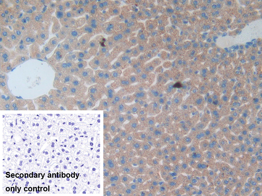 Polyclonal Antibody to Cluster Of differentiation 301 (CD301)