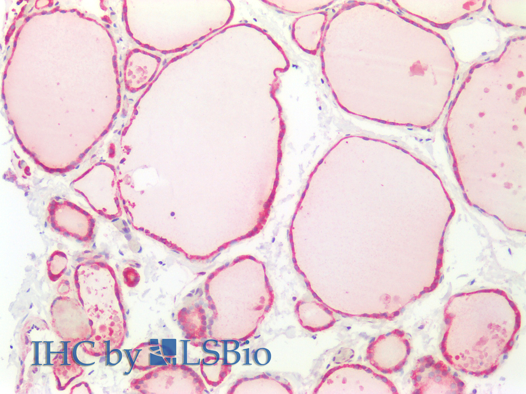 Polyclonal Antibody to C-Type Lectin Domain Family 13, Member A (CLEC13A)