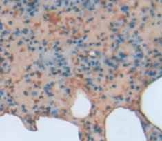 Polyclonal Antibody to B-Cell CLL/Lymphoma 3 (Bcl3)