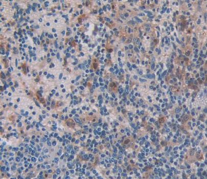 Polyclonal Antibody to Caspase 4 (CASP4)