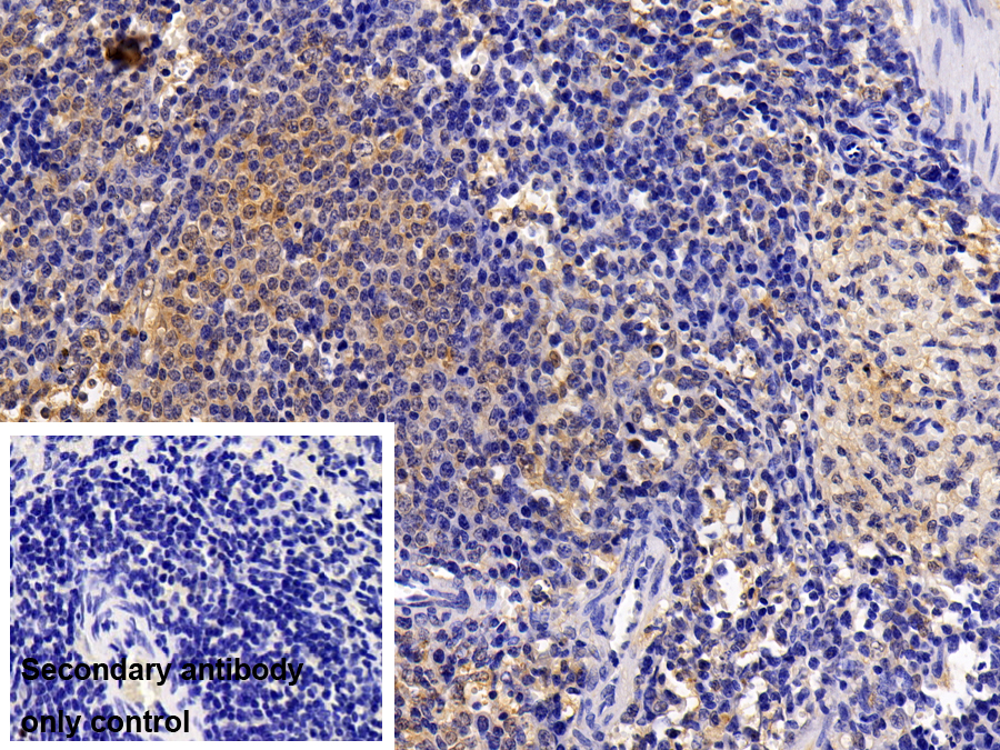 Polyclonal Antibody to Signal Transducer And Activator Of Transcription 1 (STAT1)