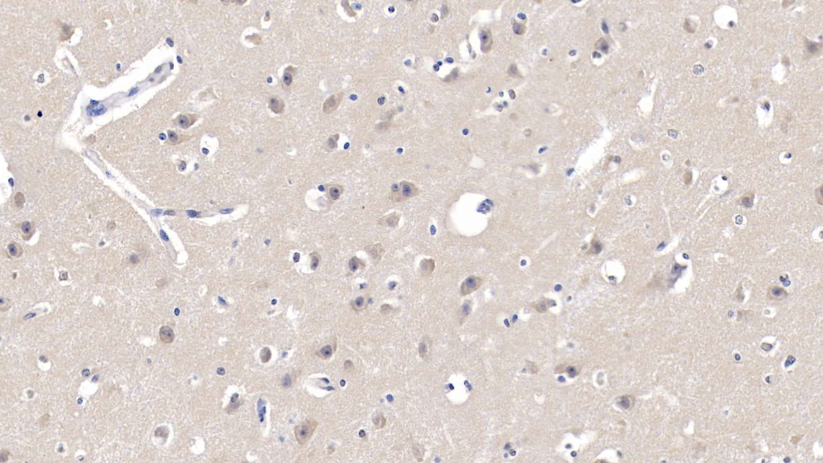 Polyclonal Antibody to Signal Transducer And Activator Of Transcription 1 (STAT1)