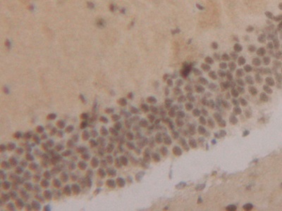 Polyclonal Antibody to Signal Transducer And Activator Of Transcription 1 (STAT1)