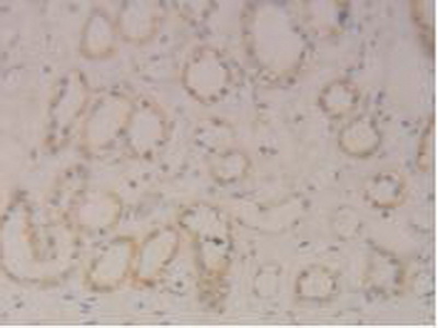 Polyclonal Antibody to Signal Transducer And Activator Of Transcription 3 (STAT3)