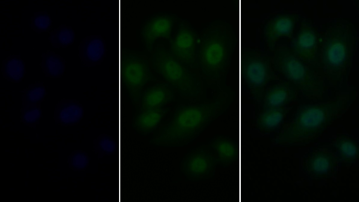 Polyclonal Antibody to Signal Transducer And Activator Of Transcription 3 (STAT3)