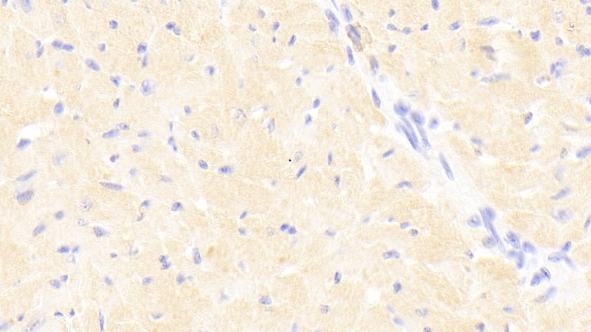 Polyclonal Antibody to Signal Transducer And Activator Of Transcription 3 (STAT3)