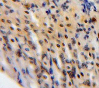 Polyclonal Antibody to Signal Transducer And Activator Of Transcription 3 (STAT3)