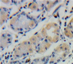 Polyclonal Antibody to Ubiquitin D (UBD)