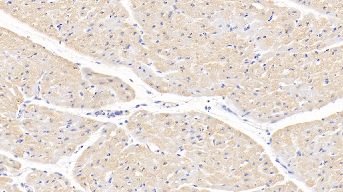 Polyclonal Antibody to Tumor Necrosis Factor Ligand Superfamily, Member 13 (TNFSF13)