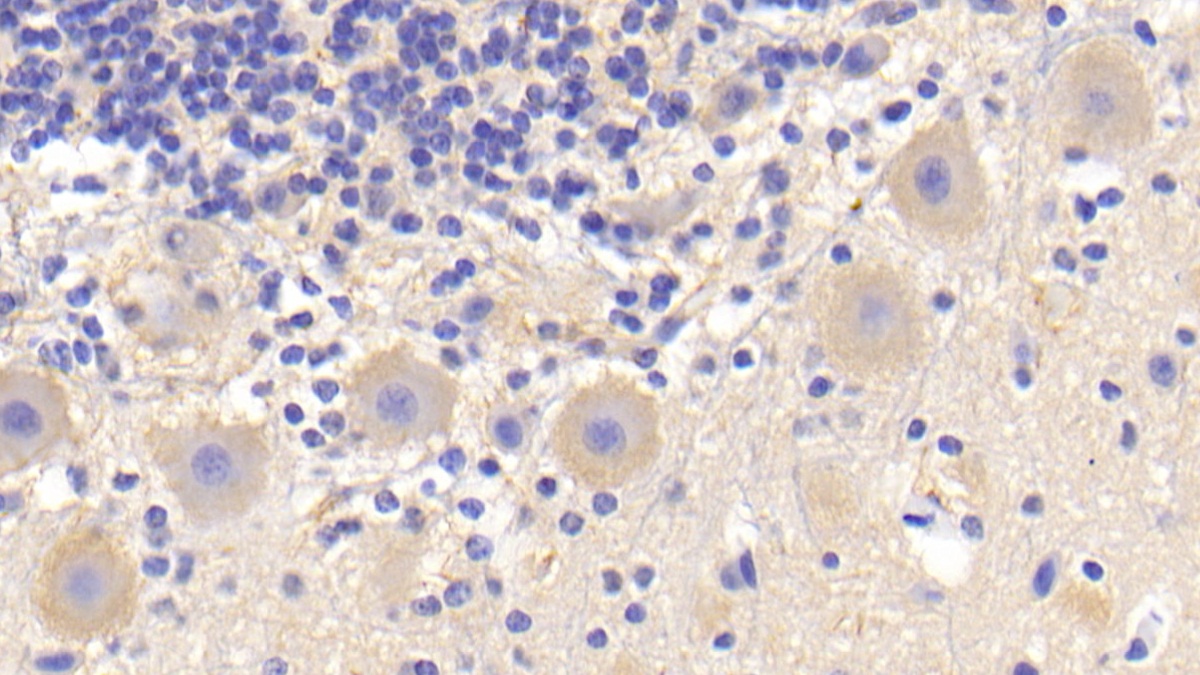 Polyclonal Antibody to Tumor Necrosis Factor Ligand Superfamily, Member 13 (TNFSF13)