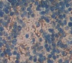 Polyclonal Antibody to EGF Like Module Containing Mucin Like Hormone Receptor 2 (EMR2)