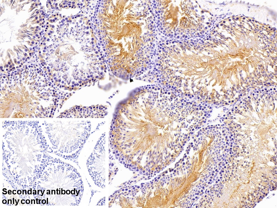 Polyclonal Antibody to Fascin (FSCN)