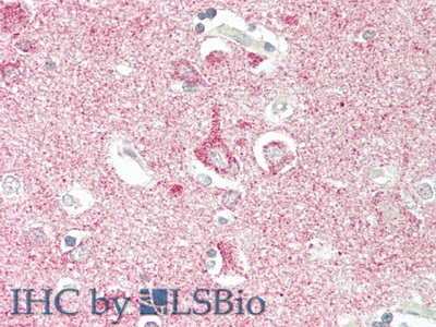 Polyclonal Antibody to Oncostatin M Receptor (OSMR)