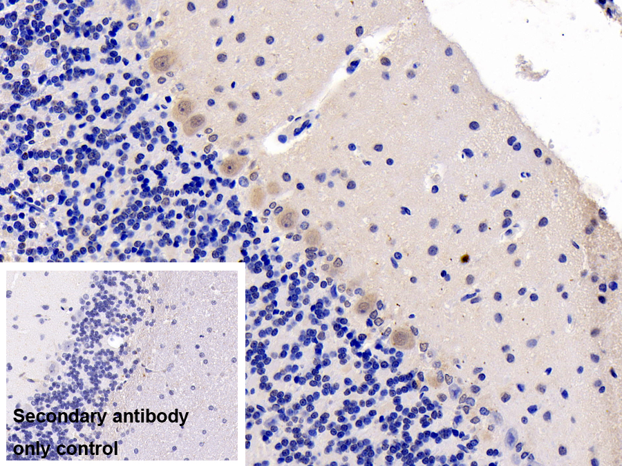 Polyclonal Antibody to Oncostatin M Receptor (OSMR)