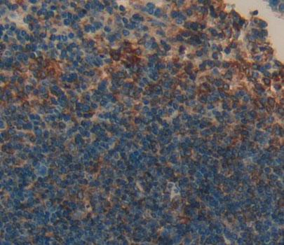 Polyclonal Antibody to Killer Cell Lectin Like Receptor Subfamily K, Member 1 (KLRK1)