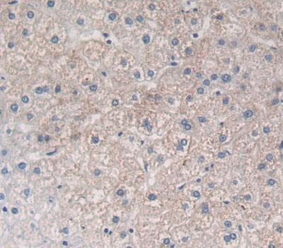 Polyclonal Antibody to Prostaglandin F2 Receptor Negative Regulator (PTGFRN)