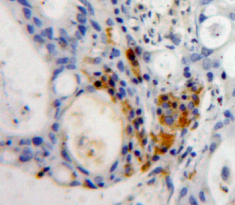 Polyclonal Antibody to Myeloid Cell Nuclear Differentiation Antigen (MNDA)