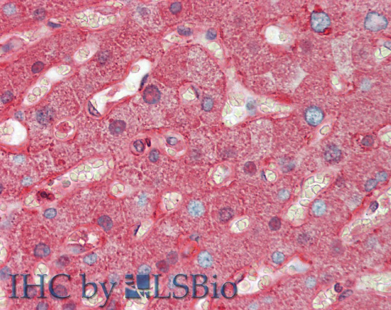 Polyclonal Antibody to Orosomucoid 2 (ORM2)