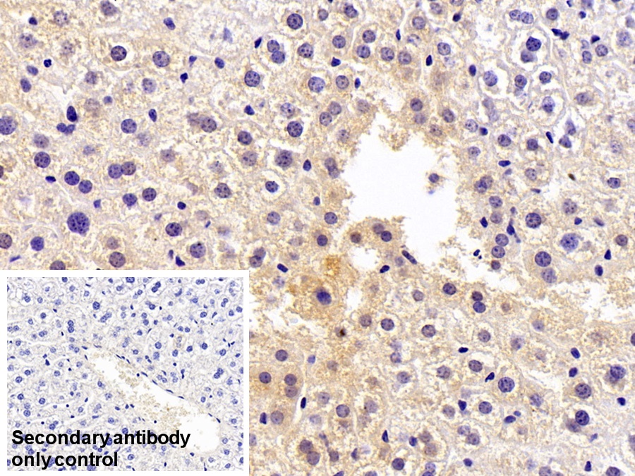 Polyclonal Antibody to Orosomucoid 2 (ORM2)