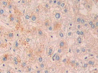 Polyclonal Antibody to Neprilysin (CD10)