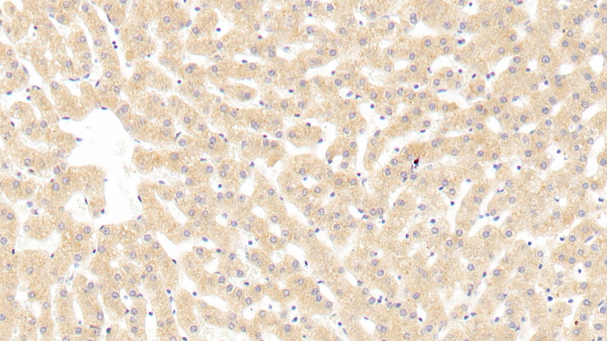 Polyclonal Antibody to Sialic Acid Binding Ig Like Lectin 8 (SIGLEC8)