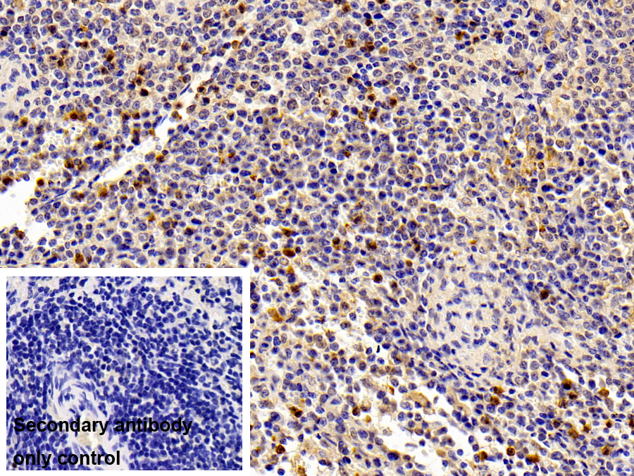 Polyclonal Antibody to S100 Calcium Binding Protein A8 (S100A8)