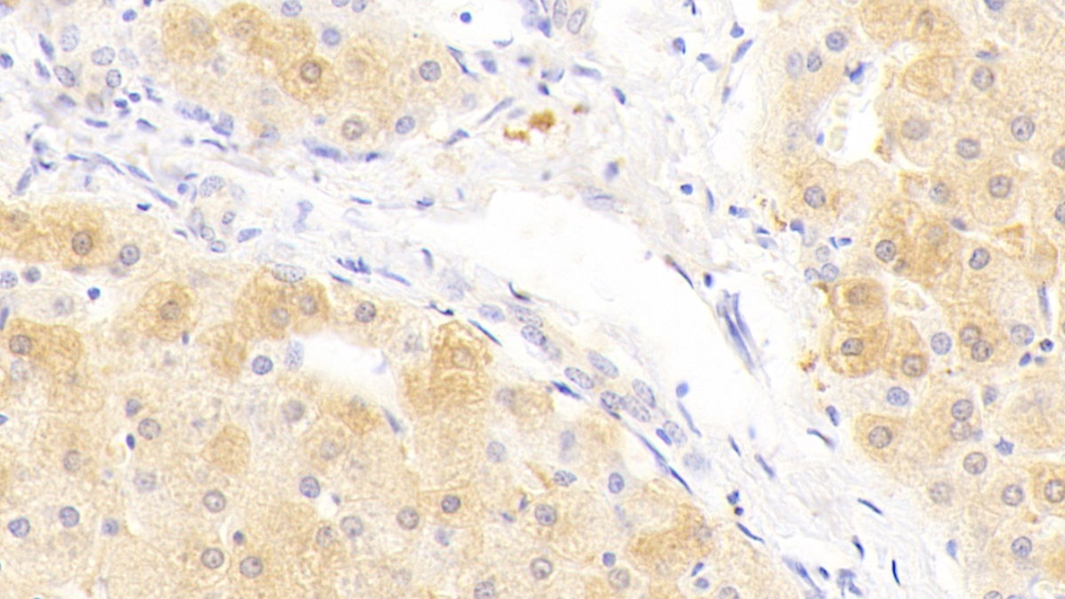 Polyclonal Antibody to Serum Amyloid A2 (SAA2)