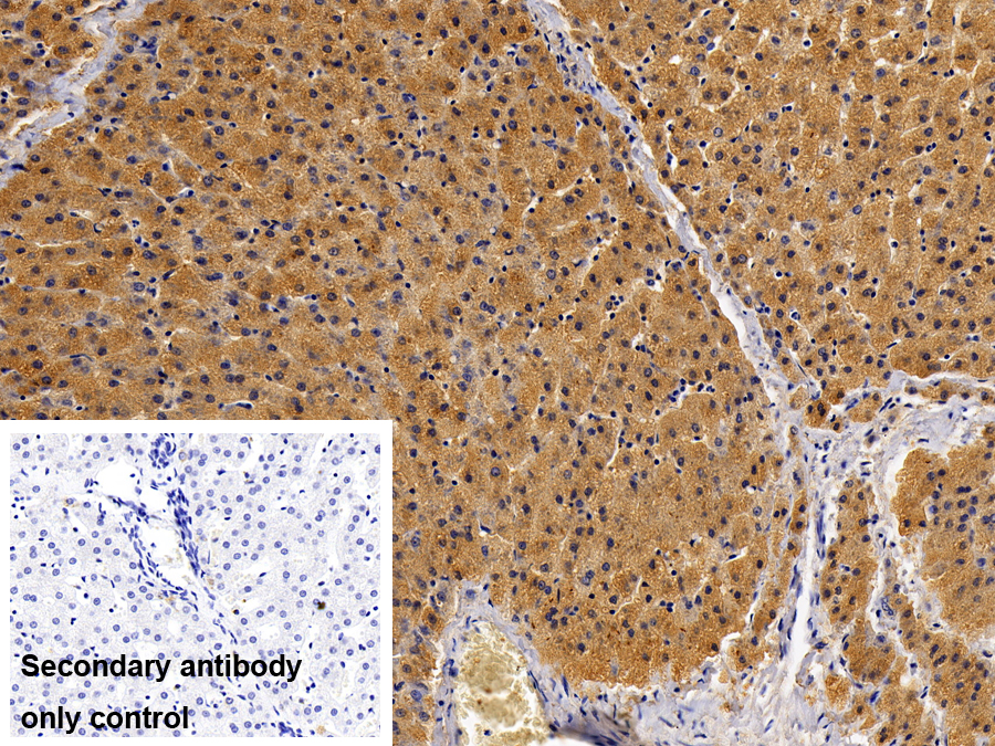 Polyclonal Antibody to Signal Transducer And Activator Of Transcription 2 (STAT2)