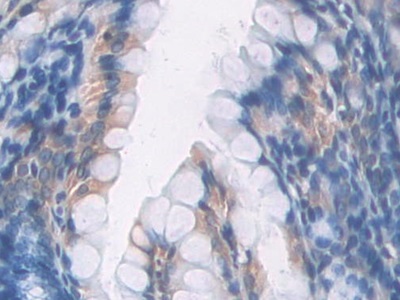 Polyclonal Antibody to Signal Transducer And Activator Of Transcription 2 (STAT2)