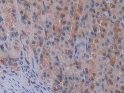 Polyclonal Antibody to Signal Transducer And Activator Of Transcription 2 (STAT2)