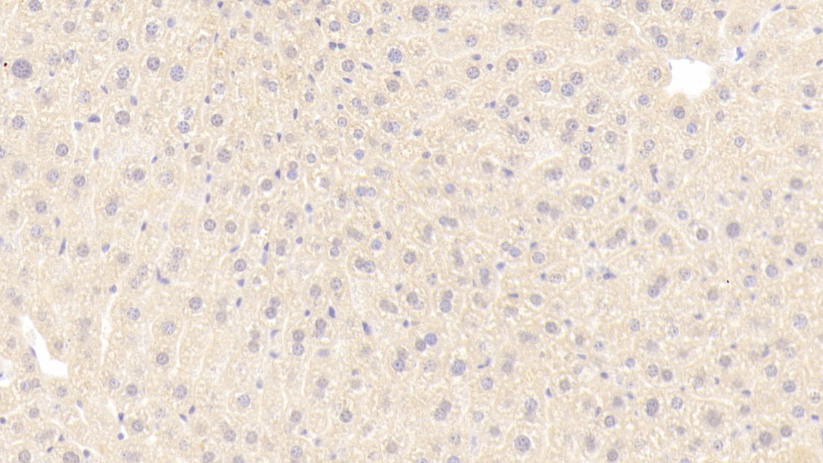 Polyclonal Antibody to Fibroblast Growth Factor Receptor 4 (FGFR4)