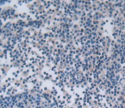 Polyclonal Antibody to Natural Cytotoxicity Triggering Receptor 1 (NCR1)