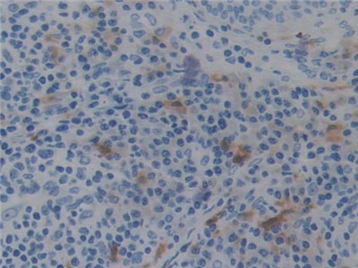 Polyclonal Antibody to Prekallikrein (PK)