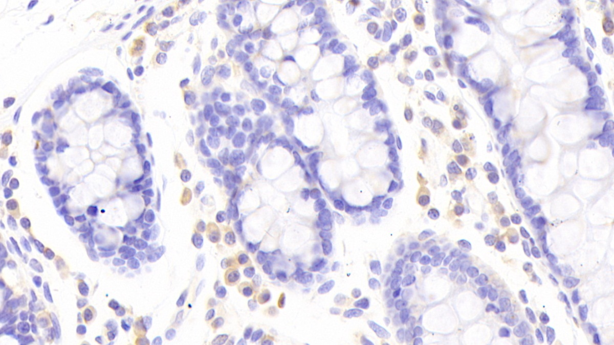 Polyclonal Antibody to Natural Cytotoxicity Triggering Receptor 2 (NCR2)