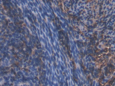 Polyclonal Antibody to High Molecular Weight Kininogen (HMWK)