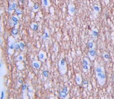 Polyclonal Antibody to Jagged 1 (JAG1)