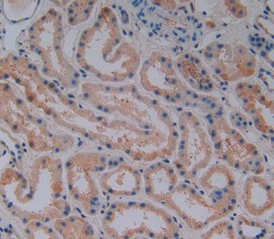 Polyclonal Antibody to Vitamin D Binding Protein (DBP)