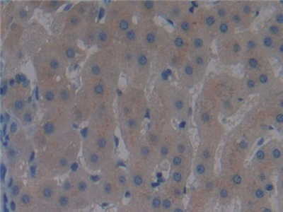 Polyclonal Antibody to Vitamin D Binding Protein (DBP)