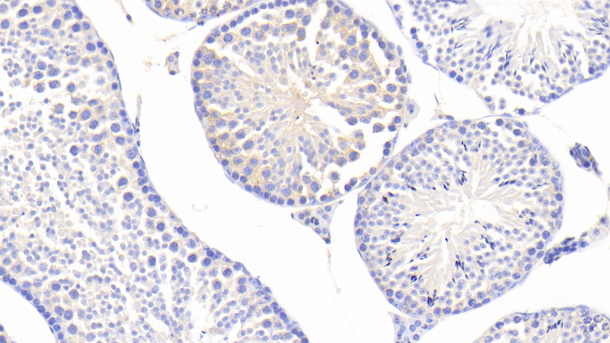 Polyclonal Antibody to Vitamin D Binding Protein (DBP)