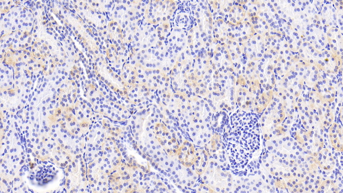 Polyclonal Antibody to Uridine Phosphorylase 1 (UPP1)